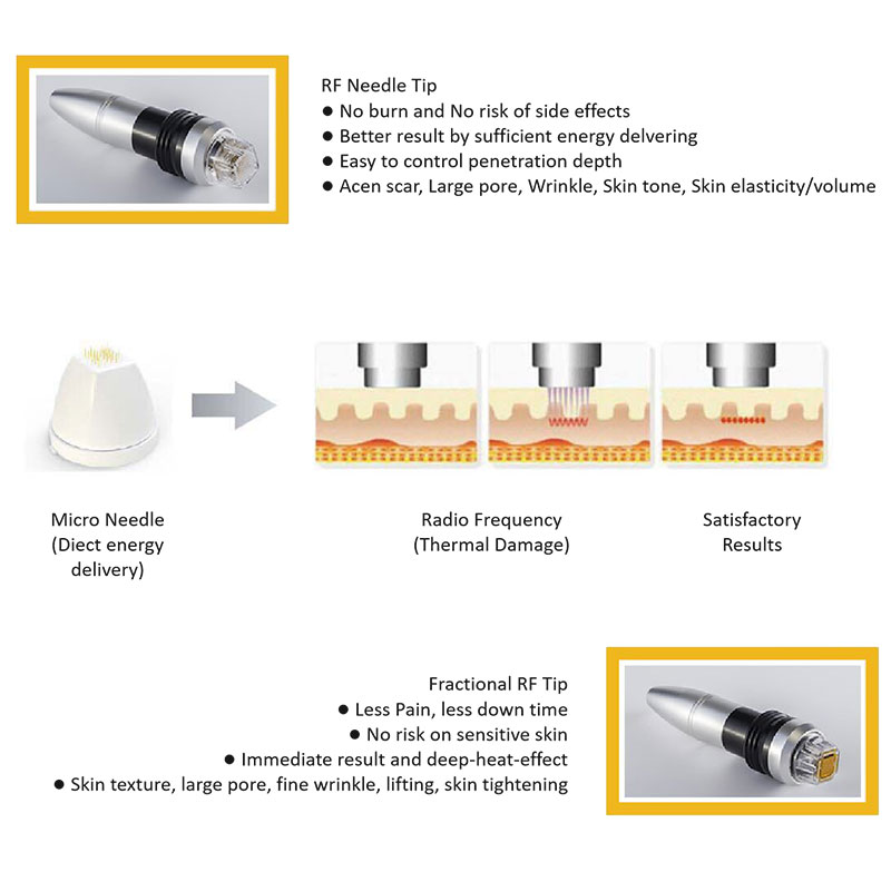 TM50-Microneedle RF Face Lifting